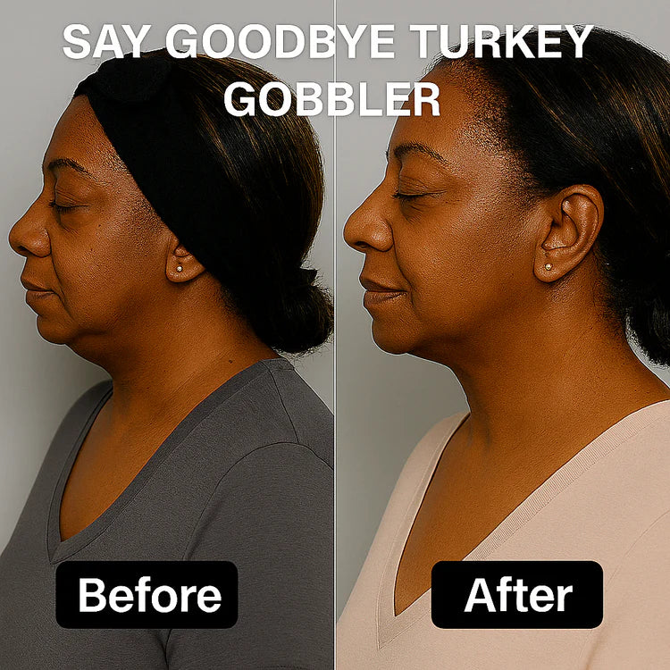 FémLift™ Face Shaper