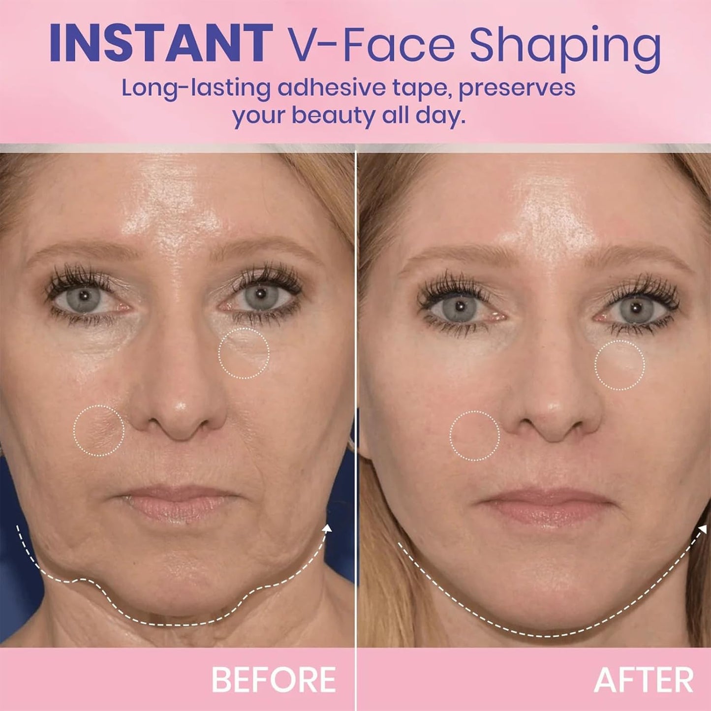 LuxeLifter™ Beauty Tape