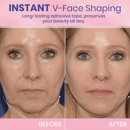 LuxeLifter™ Beauty Tape